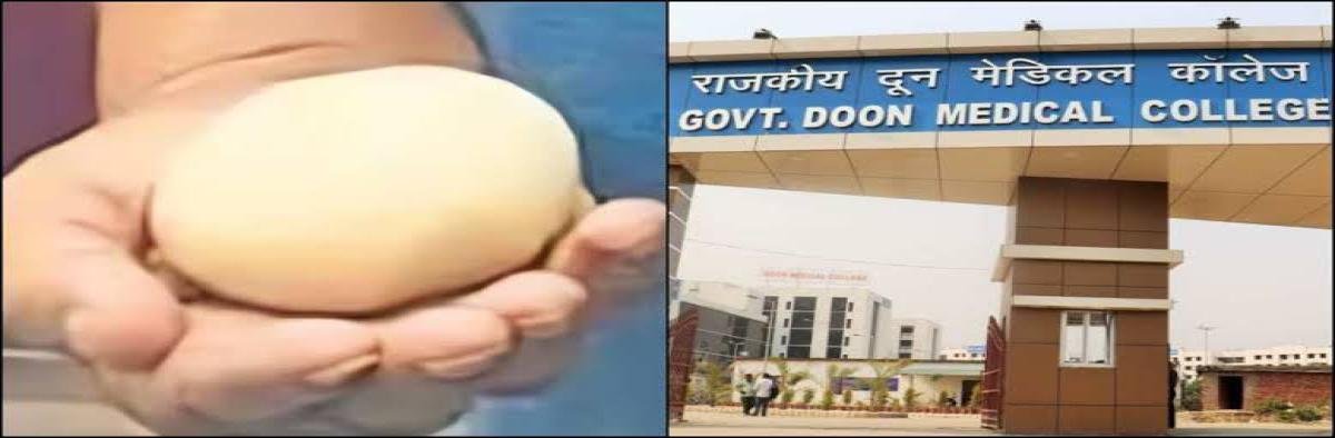 Dehradun : 78 साल के बुजुर्ग के पेट से निकला अंडे जैसा गोला,  न ट्यूमर न पथरी, पढ़ें!