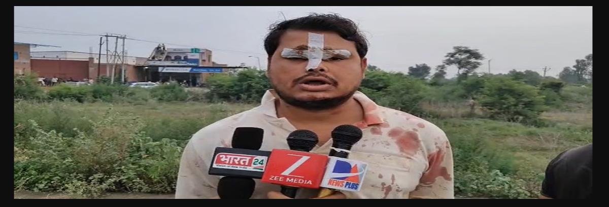 Kasganj Encounter News: फौजी के घर लूट की कोशिश नाकाम, पुलिस मुठभेड़ में दो बदमाश घायल, तीसरे ने तीसरी मंजिल से लगाई छलांग