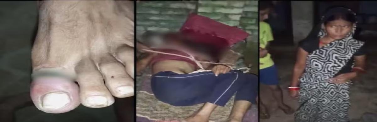 पती को रातभर बंधक बनाकर पीटा, फिर दिए बिजली के झटके ; फतेहपुर की घटना ने चौंकाया